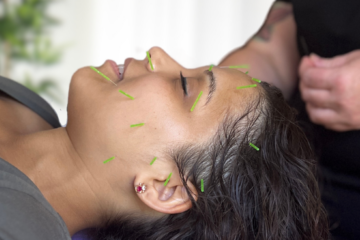 Facial Rejuvenation Acupuncture